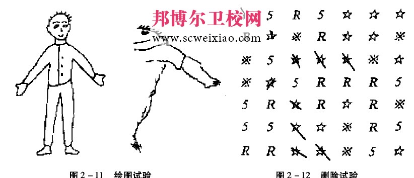 半侧空间失认症